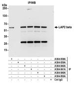LAP2 beta/TMPO Antibody in Immunoprecipitation (IP)