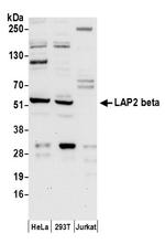 LAP2 beta/TMPO Antibody in Western Blot (WB)