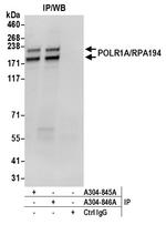POLR1A/RPA194 Polyclonal Antibody