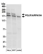 POLR1A/RPA194 Polyclonal Antibody