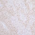 LAP2 beta gamma/TMPO Polyclonal Antibody