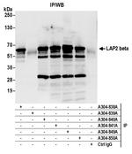 LAP2 beta gamma/TMPO Antibody in Immunoprecipitation (IP)