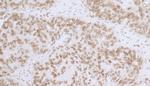LAP2 beta gamma/TMPO Polyclonal Antibody