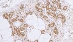 LAP2 beta gamma/TMPO Antibody in Immunohistochemistry (Paraffin) (IHC (P))