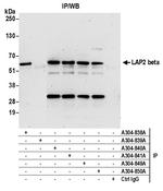 LAP2 beta gamma/TMPO Antibody in Immunoprecipitation (IP)