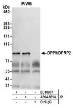 DPP9/DPRP2 Polyclonal Antibody