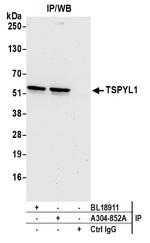 TSPYL1 Antibody in Immunoprecipitation (IP)