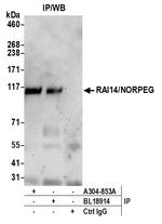 RAI14/NORPEG Antibody in Immunoprecipitation (IP)