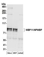 WBP11/NPWBP Polyclonal Antibody
