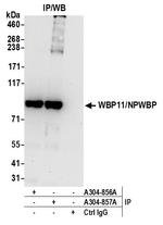 WBP11/NPWBP Polyclonal Antibody
