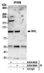 NVL Antibody in Immunoprecipitation (IP)