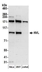 NVL Polyclonal Antibody