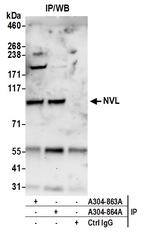 NVL Polyclonal Antibody