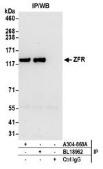 ZFR Antibody in Immunoprecipitation (IP)