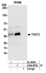 THOC3 Antibody in Immunoprecipitation (IP)