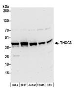 THOC3 Polyclonal Antibody