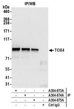 TOX4 Antibody in Immunoprecipitation (IP)