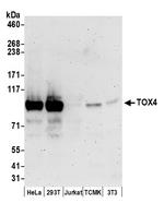TOX4 Polyclonal Antibody