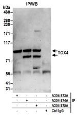 TOX4 Polyclonal Antibody