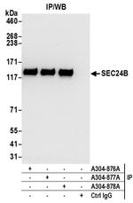 SEC24B Antibody in Immunoprecipitation (IP)