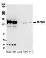 SEC24B Polyclonal Antibody