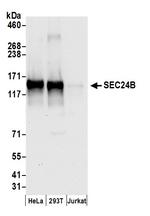 SEC24B Polyclonal Antibody