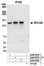 SEC24B Polyclonal Antibody