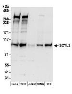 SCYL2 Polyclonal Antibody