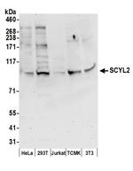 SCYL2 Polyclonal Antibody