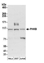 PHKB Polyclonal Antibody
