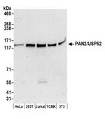 PAN2/USP52 Polyclonal Antibody