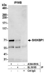 SH3KBP1 Binding Protein 1/SHKBP1 Antibody in Immunoprecipitation (IP)