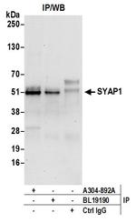 SYAP1 Antibody in Immunoprecipitation (IP)