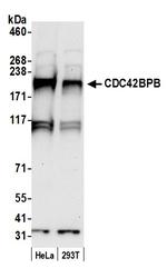 CDC42BPB/MRCK beta Polyclonal Antibody