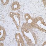 AIMP1/EMAPII/SCYE1 Polyclonal Antibody