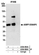 AIMP1/EMAPII/SCYE1 Antibody in Immunoprecipitation (IP)