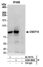 CNOT10 Antibody in Immunoprecipitation (IP)