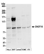 CNOT10 Polyclonal Antibody