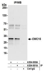 CWC15 Antibody in Immunoprecipitation (IP)