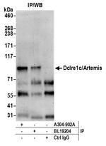 Dclre1c/Artemis Antibody in Immunoprecipitation (IP)