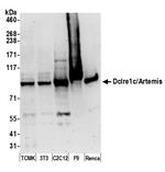 Dclre1c/Artemis Polyclonal Antibody