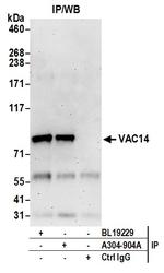 VAC14 Antibody in Immunoprecipitation (IP)