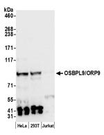 OSBPL9/ORP9 Polyclonal Antibody