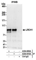 LRCH1 Antibody in Immunoprecipitation (IP)