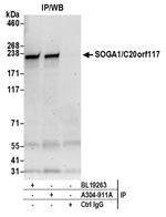 SOGA1/C20orf117 Polyclonal Antibody