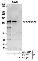 RABGAP1 Polyclonal Antibody