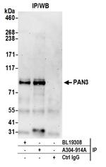 PAN3 Antibody in Immunoprecipitation (IP)