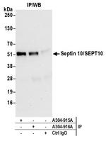 Septin 10/SEPT10 Antibody in Immunoprecipitation (IP)