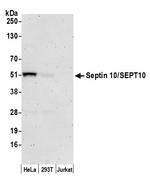 Septin 10/SEPT10 Polyclonal Antibody