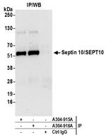 Septin 10/SEPT10 Polyclonal Antibody